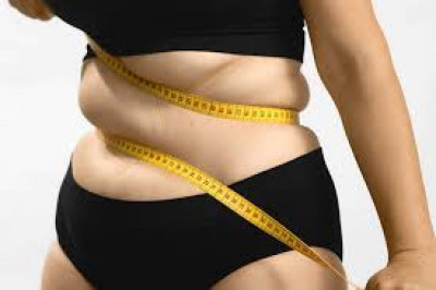 Bariatric Surgery in Islamabad: 