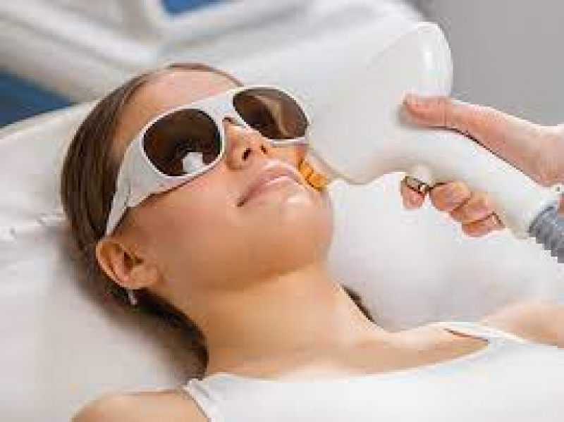 Laser hair removal in Islamabad