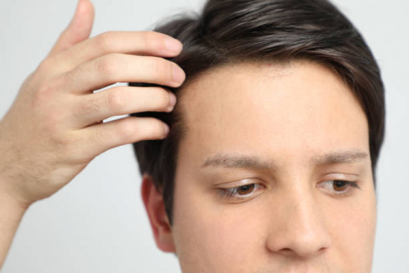 a synthetic or natural-looking head covering that covers all or most of the head in order to look more stylish or attractive.: 