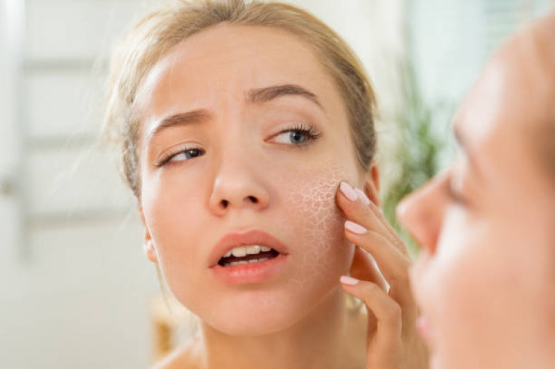 Dry skin treatment in Islamabad