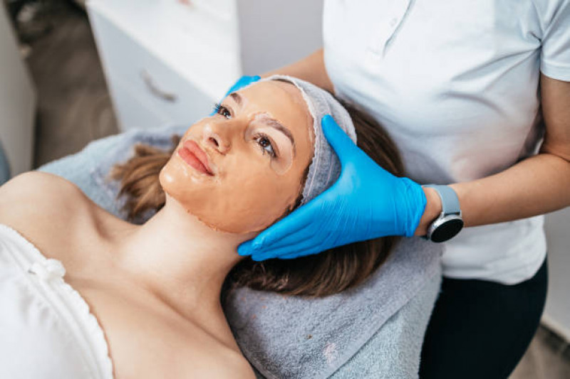 Chemical Peels in Islamabad, Rawalpindi & Pakistan
